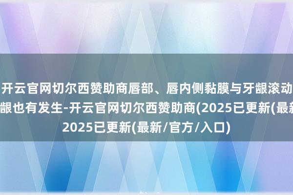 开云官网切尔西赞助商唇部、唇内侧黏膜与牙龈滚动处、腭部及牙龈也有发生-开云官网切尔西赞助商(2025已更新(最新/官方/入口)